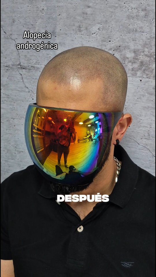 Cambio de imagen con efecto rapado completo tras SMP